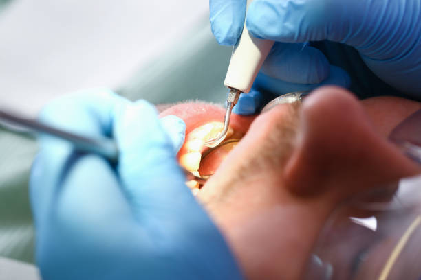 Best Holiday Emergency Dentist in Woodway, TX