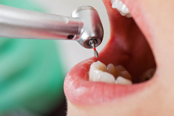 Best Emergency Dental Care for Abscessed Tooth in Woodway, TX